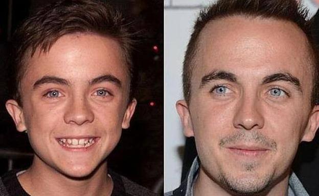 El terrible pasado del protagonista de 'Malcolm in the Middle'