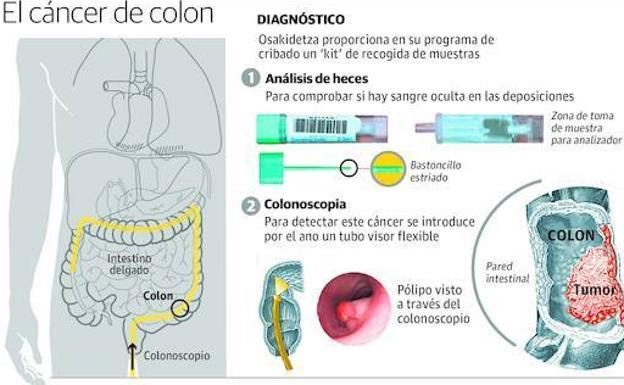 Los programas de prevención reducirán un 26% las muertes por cáncer colorrectal en 30 años