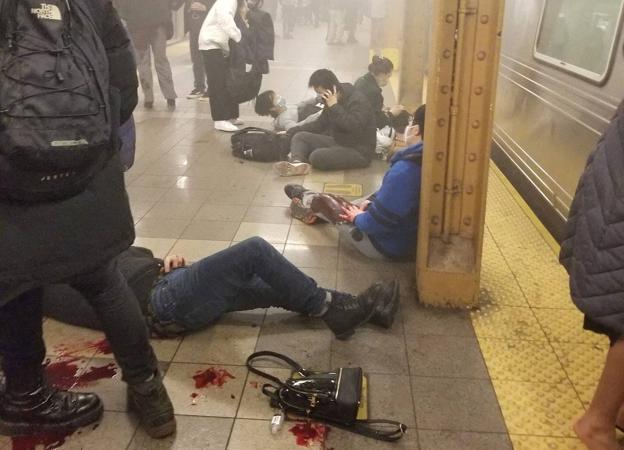 Shooting without cause.  Injured on the platform of the 36th Street subway station in New York. 